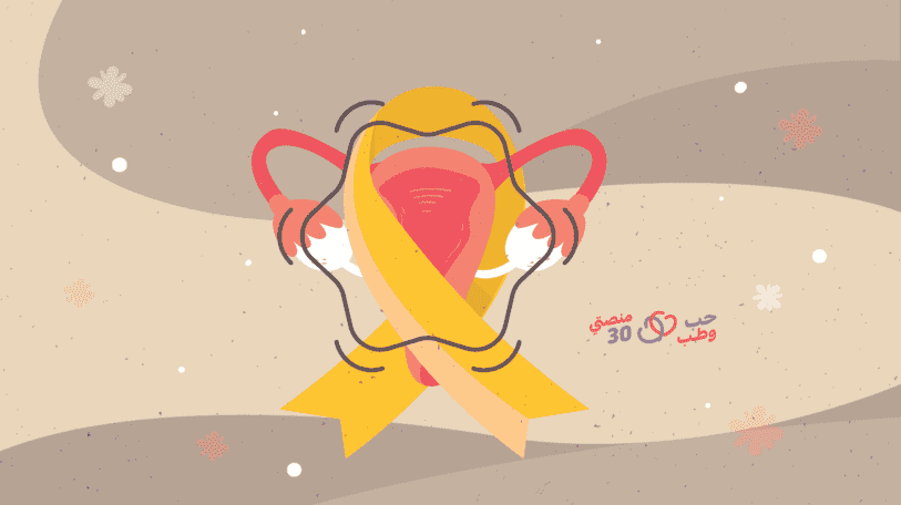 سرطان المبيض.. القاتل بصمت