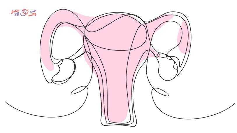 هواء الرحم.. الأسباب والعلاج